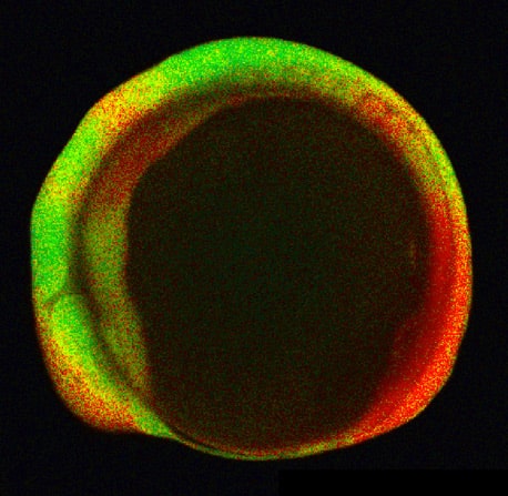 Confocal Laser Scanning Microscope- Image sample