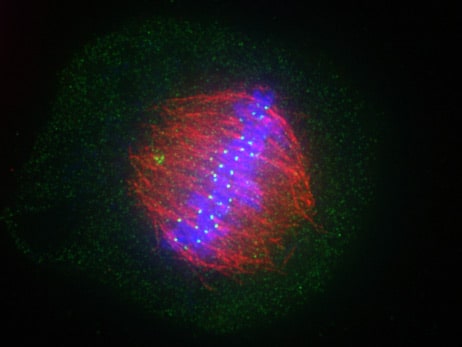 High Resolution Fluorescence Microscopy Imaging System- Image sample