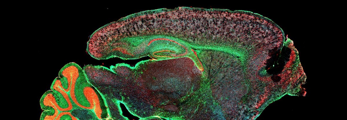 Neural Regeneration and Brain Repair