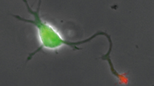 Systems Neurobiology and Medicine
