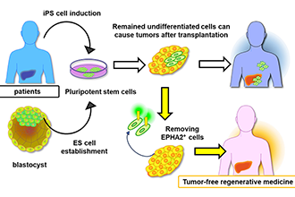 Tackling the hurdle of tumor formation in stem cell therapies