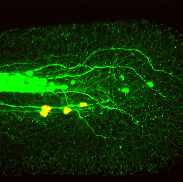 Light Sheet Fluorescence Microscope- Image sample