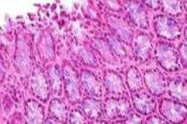 悪玉菌の増殖を抑え、腸内細菌をIgA抗体で制御  ～腸内細菌叢改善薬の開発に道～