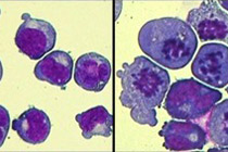 クルクミンの抗腫瘍効果を60倍以上高めた化合物を開発<br />
～副作用のない飲む抗がん剤の開発に期待～