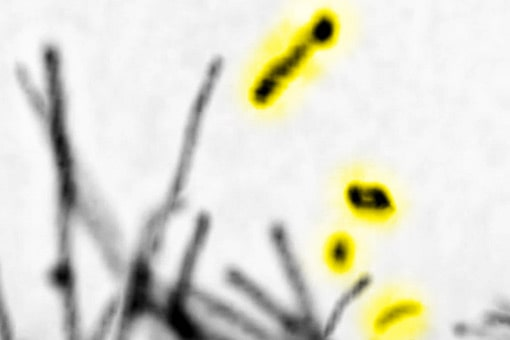 細胞間の情報伝達に関わる細胞外微粒子の新たな形成機構を解明 ～細胞膜の突起の切断により生成、細胞の移動を速める～