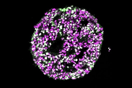 視床下部の小領域の作り分けに成功<br />
〜脳の複雑さが生み出されるメカニズムの一端が明らかに〜