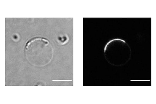 細胞の膜の形を変えて整えるタンパク質の集合機構を初めて解明<br />
～免疫反応やがん細胞の転移の動的な仕組みの究明に期待～