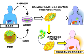 移植後の腫瘍形成を阻止できる iPS 細胞の新たな重要因子を発見<br />
～残存する未分化 iPS 細胞を除去し、再生医療で懸念される腫瘍化のリスクを減らす技術開発が可能に～
