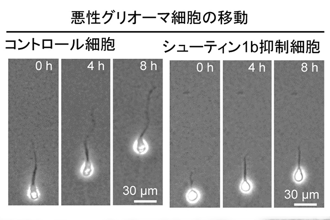 細胞移動と悪性脳腫瘍の浸潤を推進する仕組みを解明<br />
～難治性がんの治療法開発に期待～